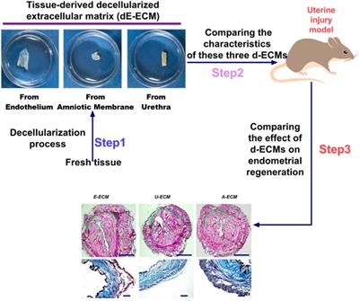 Comparing the Characteristics of Amniotic Membrane-, Endometrium-, and Urinary-Derived ECMs and Their Effects on Endometrial Regeneration in a Rat Uterine Injury Model